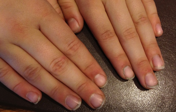 dirty fingernails